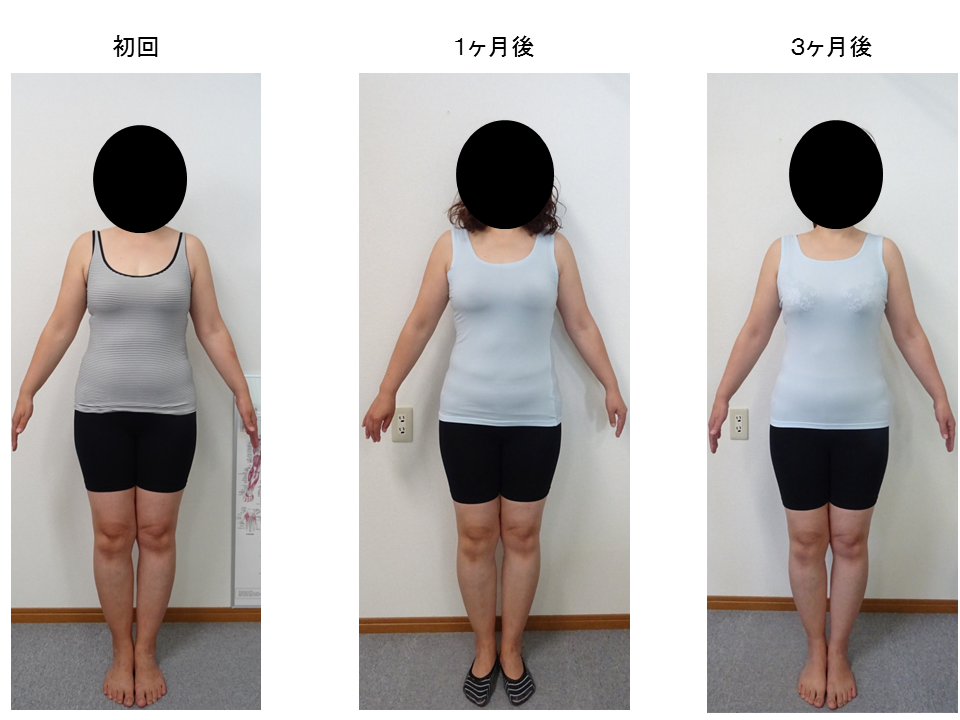 �G�X�e�ł͂���܂���V�����e���̂ł�