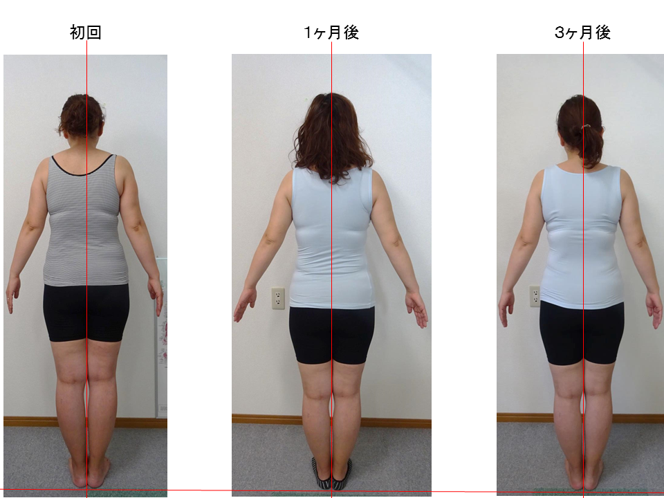 �G�X�e�ł͂���܂���V�����e���̂ł�